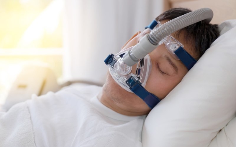 Apnea del sueño aparatos dentales y alternativas a CPAP